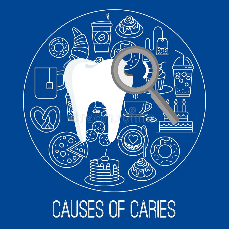 Causes of caries poster. With icons of coffee sweets. Factors provoking caries. Medicine symbols for info graphics websites and print media. Flat style design stock illustration