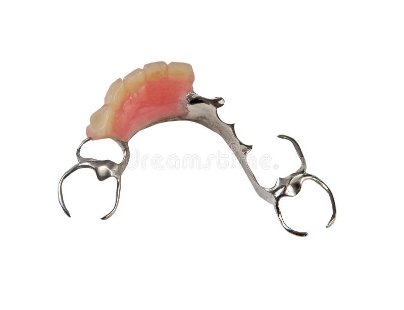 Chromium removale partial denture royalty free stock photography