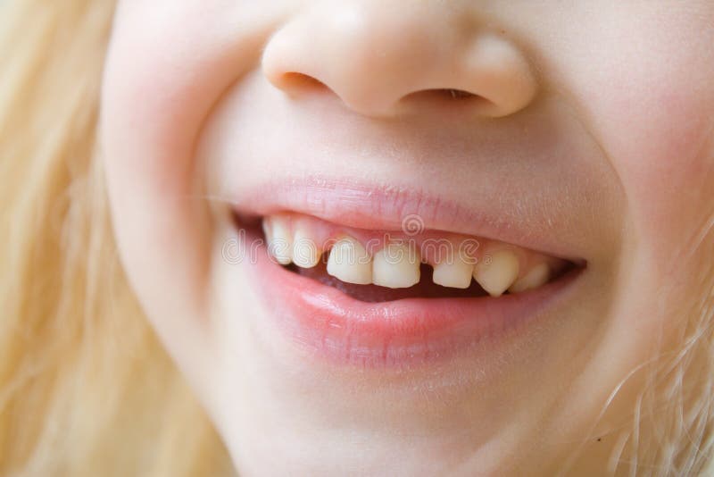 Close up mouth of smiling baby girl with milk teeth and her First molar teeth. Health care, dental hygiene and childhood concept stock images