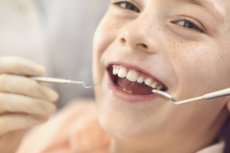 Close-up smiling child boy check-up in dentist office. Caries prevention and dental treatment. stock image