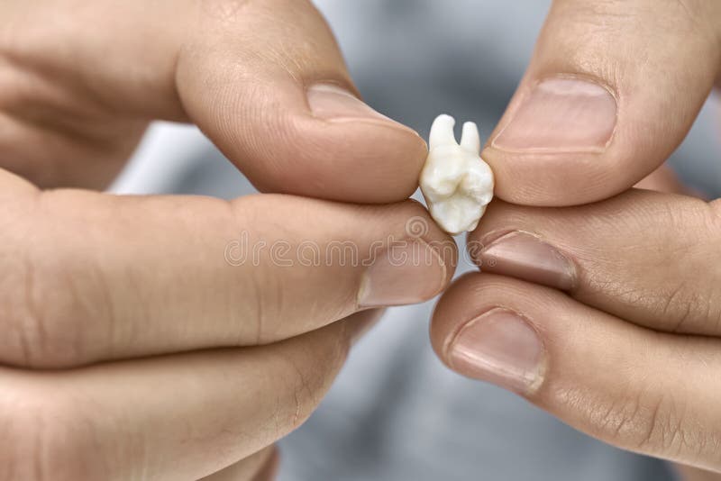 Closeup view at white molar tooth in male hands. Male hands are holding an extracted molar tooth on the blurred background. Closeup horizontal photo royalty free stock photo