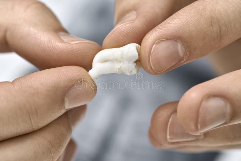 Closeup view at white molar tooth in male hands. Man`s hands are holding an extracted molar tooth on the blurred background. Closeup horizontal photo stock photo