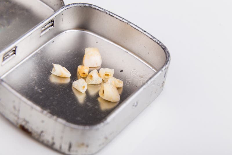 Collection of extracted milk teeth kept in box stock images