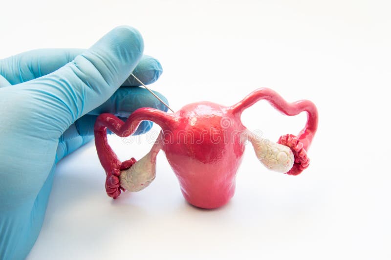 Concept photo of gynecological surgical procedure of biopsy female reproductive organs and tissues - uterine, endometrium or ovari. Es. Doctor in glove royalty free stock images Concept photo of gynecological surgical procedure of biopsy female reproductive organs and tissues - uterine, endometrium or ovari. Es. Doctor in glove royalty free stock images