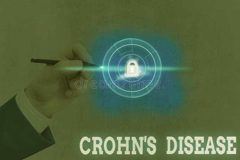Conceptual hand writing showing Crohn Disease. Business photo showcasing the chronic inflammatory disease of the intestines. Conceptual hand writing showing royalty free stock images