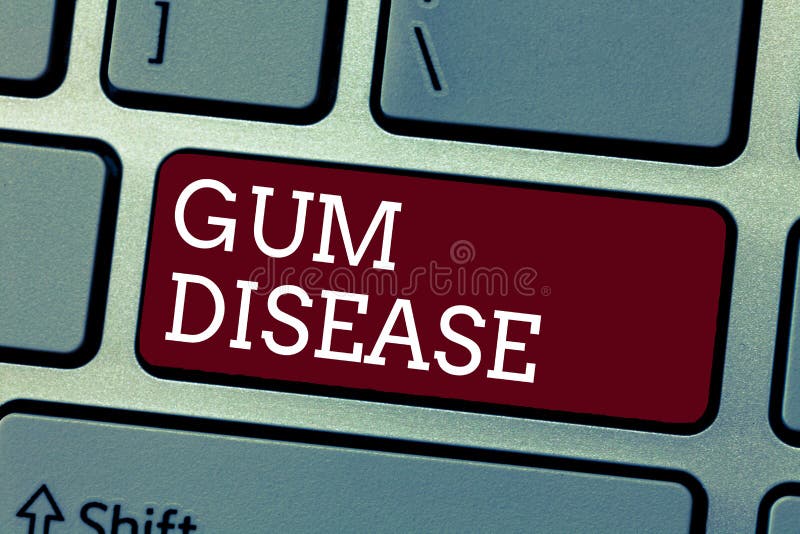 Conceptual hand writing showing Gum Disease. Business photo showcasing Inflammation of the soft tissue Gingivitis. Periodontitis stock photo