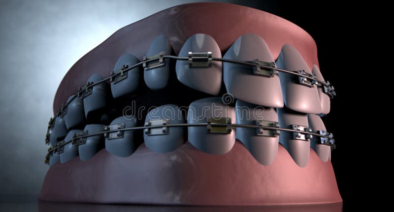 Creepy Teeth With Braces stock illustration