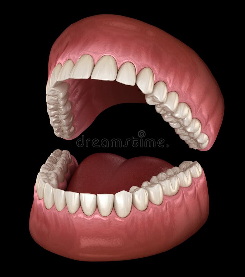 Dental anatomy - Opened Dentures. Medically accurate dental royalty free illustration