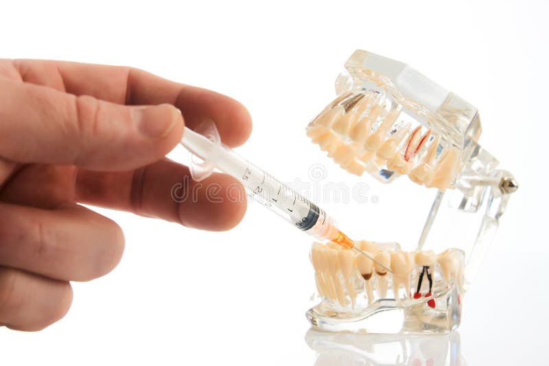 Dental anesthesia concept, close-up. Doctor dentist holding syringe, needle stabs into jaw between the teeth, pursuing dental anesthesia procedure. Dental stock photography