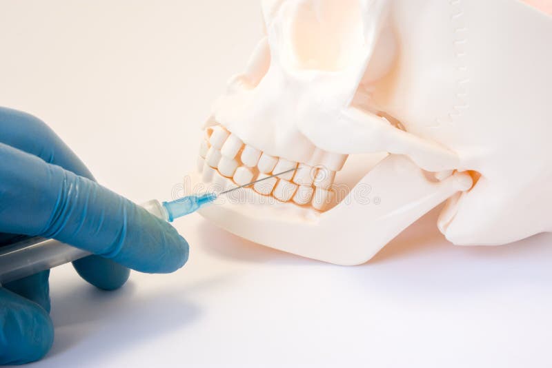 Dental anesthesia or puncture cyst tooth concept photo. Doctor dentist holding syringe, needle stabs into upper jaw of skull above. The teeth, pursuing dental stock images