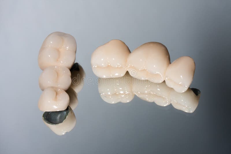 Dental bridge stock image