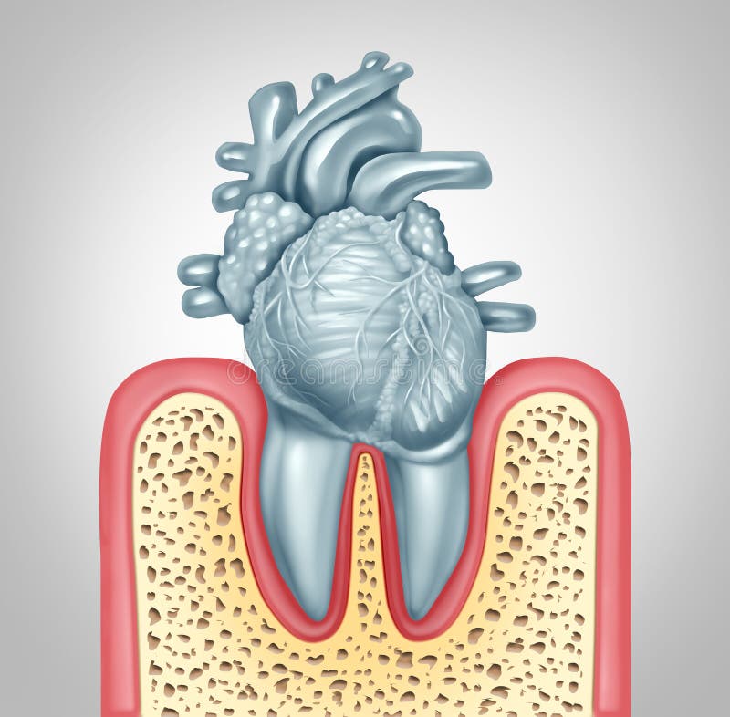 Dental Care Heart Disease. Dental care or oral health and heart disease hygiene concept caused by tooth plaque and gum infection due to mouth bacteria damaging royalty free illustration