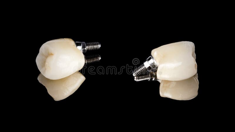 Dental ceramic molar crown on the implant. View from different sides, isolated on a black background. artificial human tooth. Implant prosthetics concept royalty free stock photography