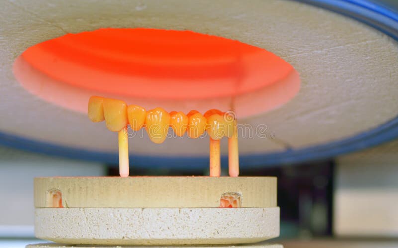 Dental crowns, ceramics, furnace stock image