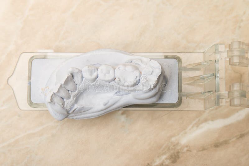 Dental Mold For Prosthetic Teeth. Dental mold and models with prosthetic teeth for cermet in the dental lab royalty free stock images