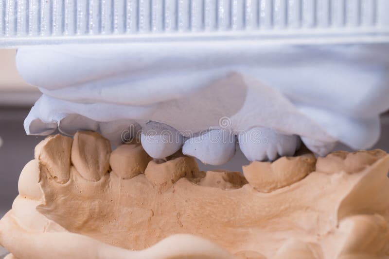Dental Mold For Prosthetic Teeth. Dental mold and models with prosthetic teeth for cermet in the dental lab royalty free stock photo