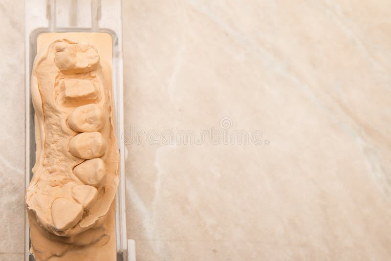 Dental Mold For Prosthetic Teeth. Dental mold and models with prosthetic teeth for cermet in the dental lab stock images