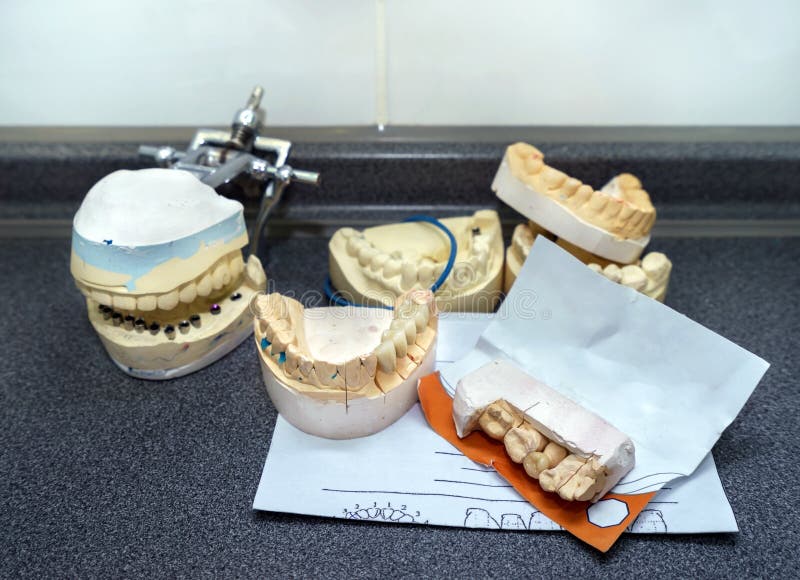 Dental molds for prosthetic teeth. Dental molds and models with prosthetic teeth for cermet in the dental lab stock photo