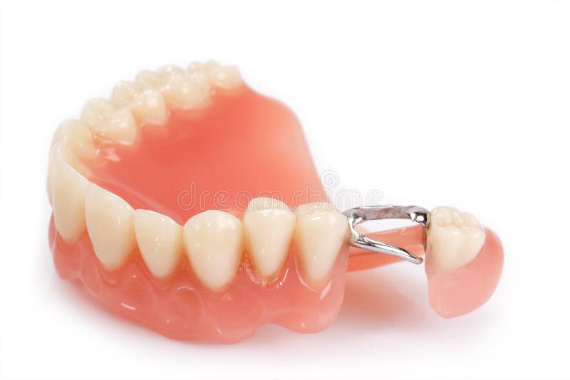 Dental prosthesis royalty free stock photos