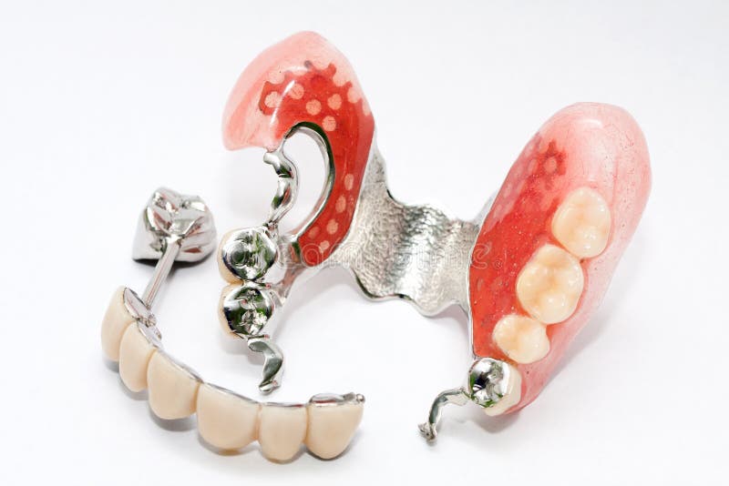 Dental prosthesis royalty free stock photography