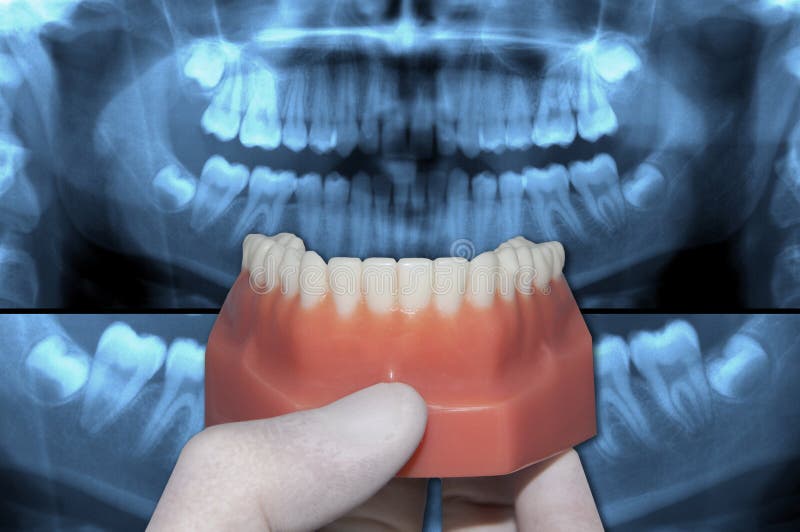 Dentist show lower dental arch over x-ray teeth. Dentist show inferior arch over x-ray teeth stock photos