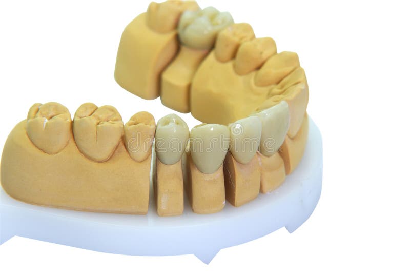 Dentures with porcelain teeth vector illustration