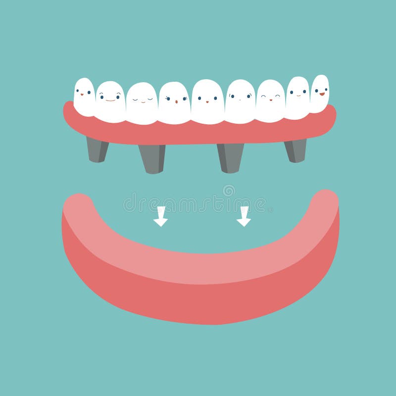 Dentures ,teeth and tooth concept of dental stock illustration