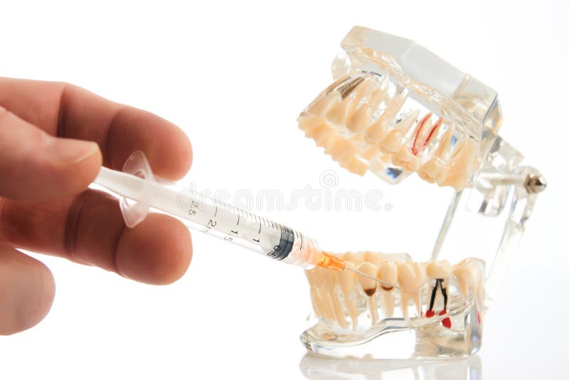Dental anesthesia concept, close-up. Doctor dentist holding syringe, needle stabs into jaw between the teeth, pursuing dental anesthesia procedure. Dental stock image