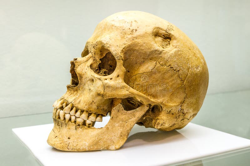 Exposed human skull. Human skull exposed on white sufface stock images