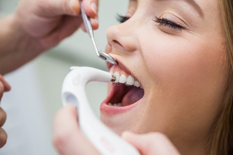 Female Patient Treated With Dental Equipment For Determination Accurate Tooth Color stock image