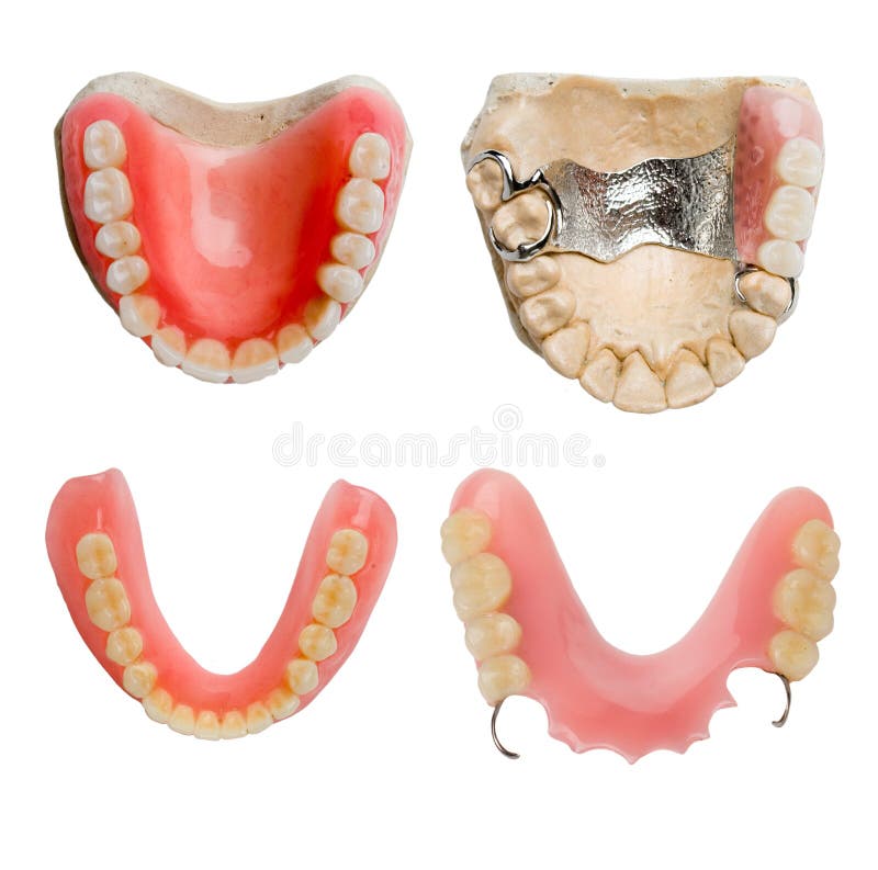 Full size dental prosthesis collection royalty free stock photography