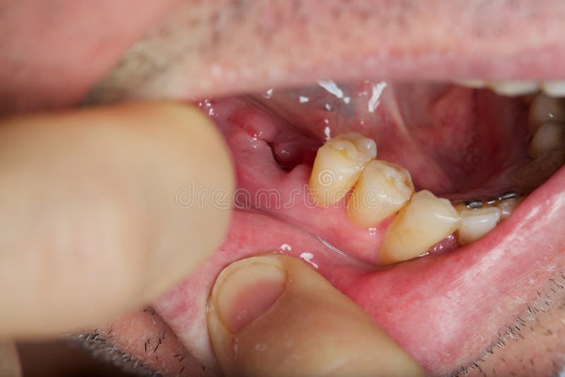 Gum of an adult without teeth. Extreme closeup royalty free stock photo