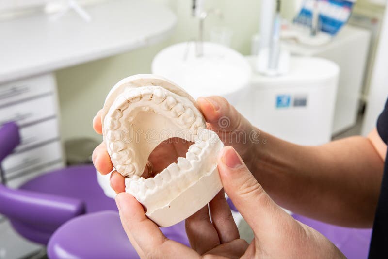 Gypsum model of jaw with teeth in in the hands of a dentist royalty free stock photos