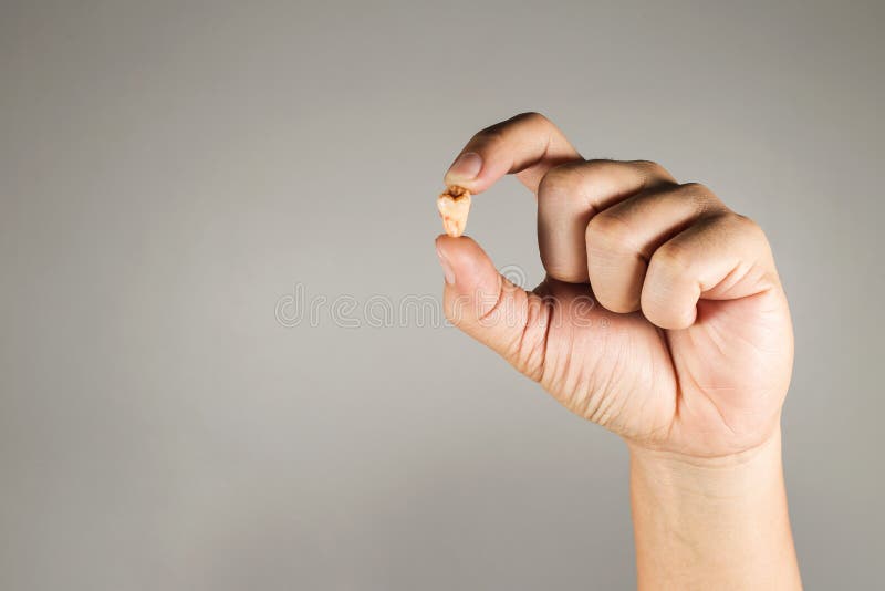 Hand holding are tooth decay and fall out from the mouth. Hand holding are tooth decay royalty free stock images