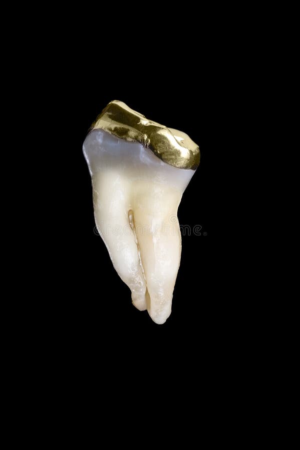 Human molar tooth. A 45 year old human molar tooth with a gold crown isolated on black stock image