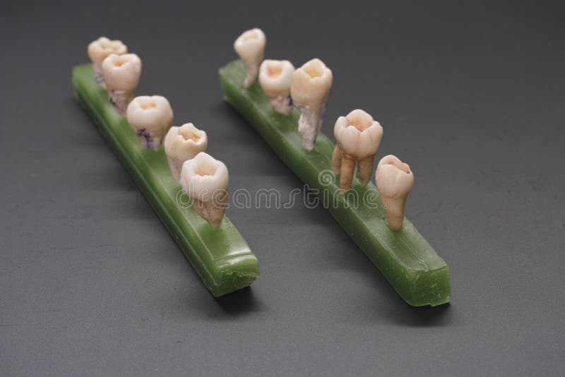 Human natural tooth. Natural human tooth cleaned and prepared for filling with ceramic composite material. They are used in laboratory for students in research stock image