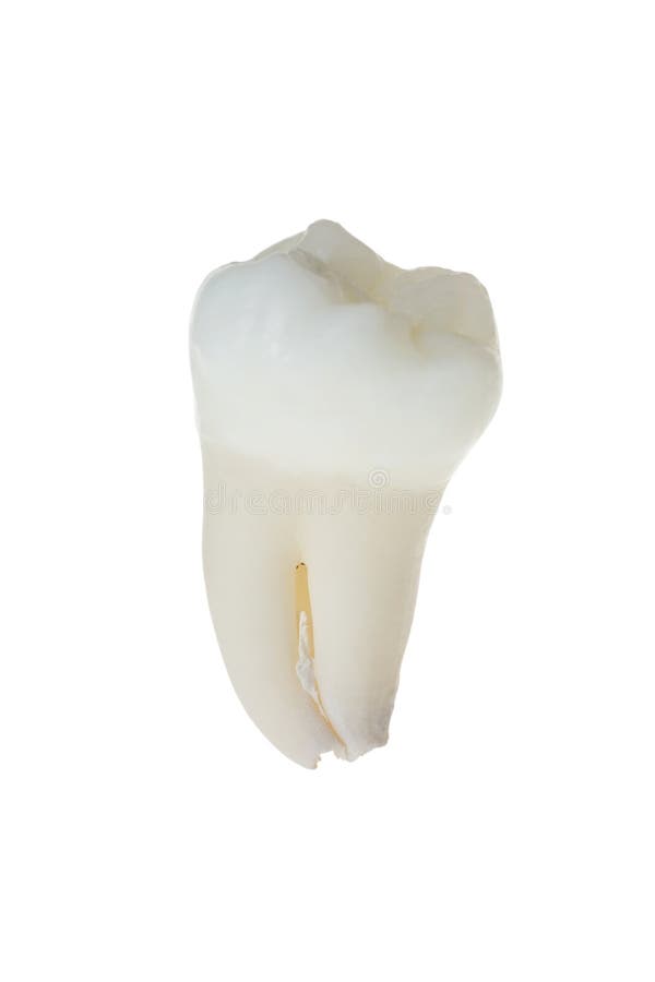 Human tooth. A real human tooth on white royalty free stock photos