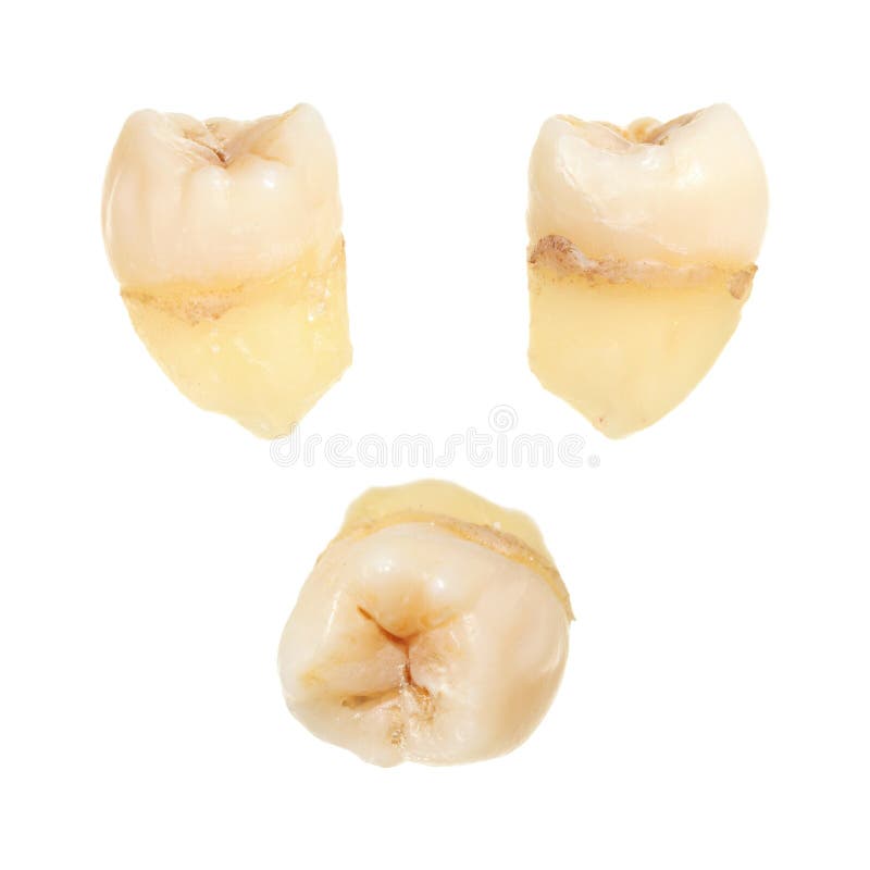 Human tooth. Human wisdom tooth isolated on white background stock images