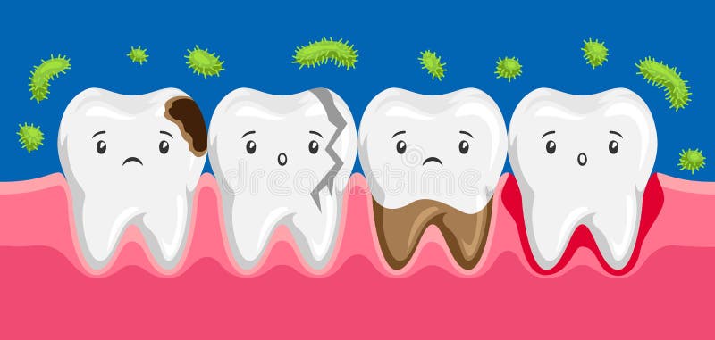 Illustration of sick teeth in oral cavity. Children dentistry sad characters. Kawaii facial expressions vector illustration