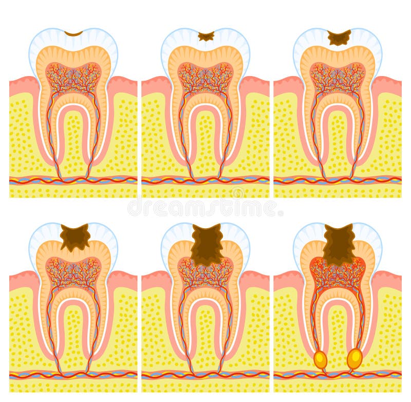 Internal structure of tooth stock illustration