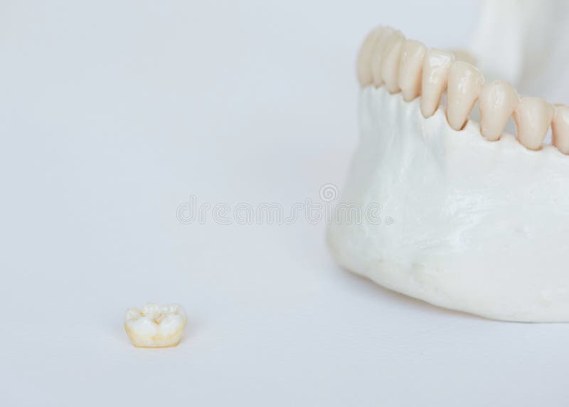 Molar tooth and jaw bone model on white background. Molar tooth and artificial human jaw bone model on white background stock image