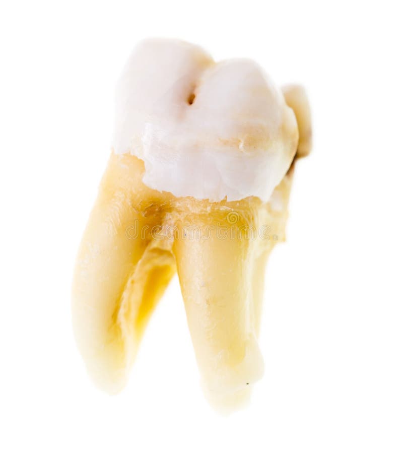 Old torn tooth on a white background royalty free stock photo