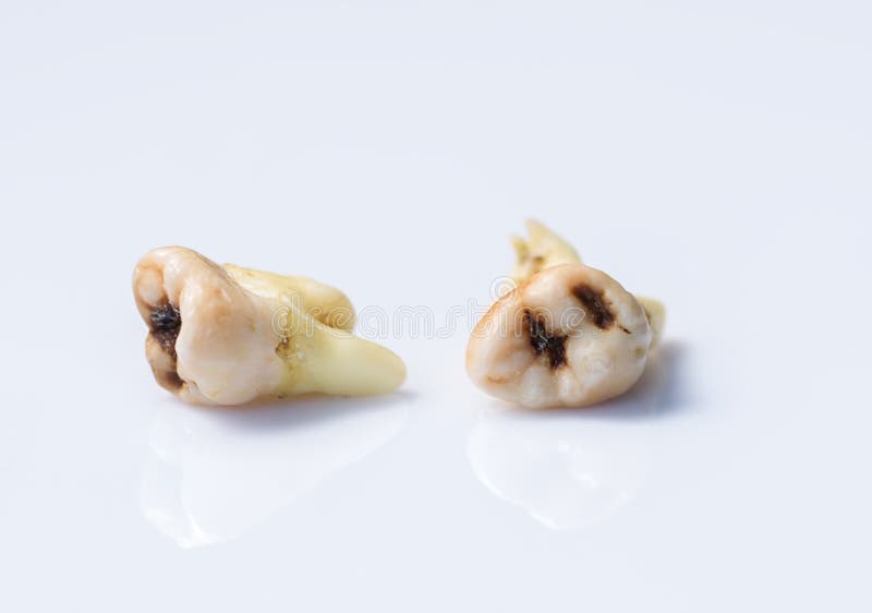 Old torn tooth on white background stock image
