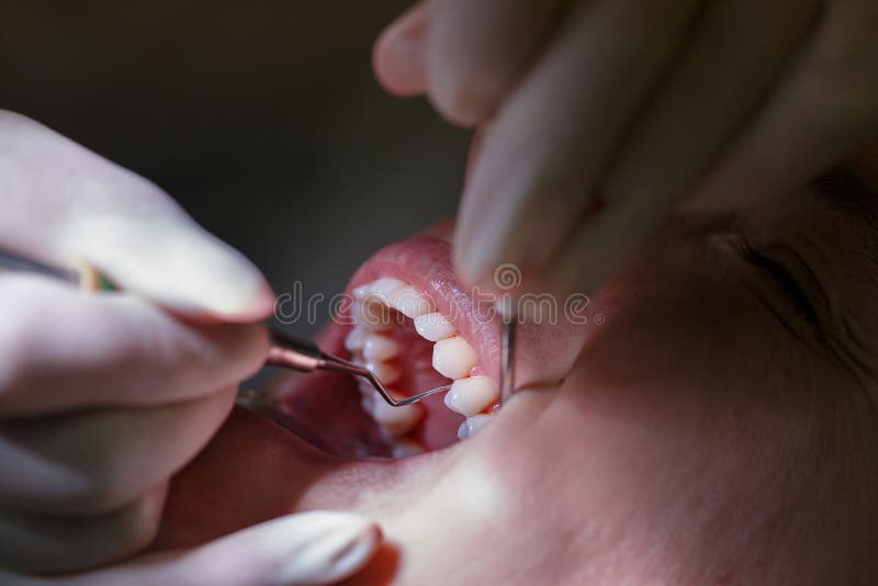 Patient at dental hygienists office stock image