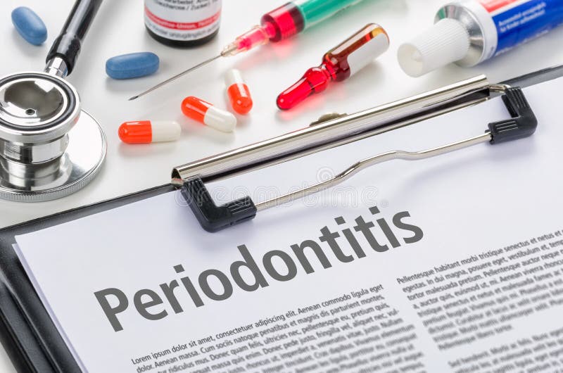 Periodontitis written on a clipboard. The diagnosis Periodontitis written on a clipboard royalty free stock photo