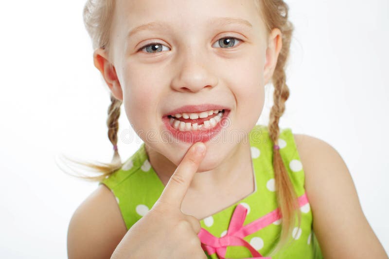 Portrait of a funny little girl without one front tooth stock photos