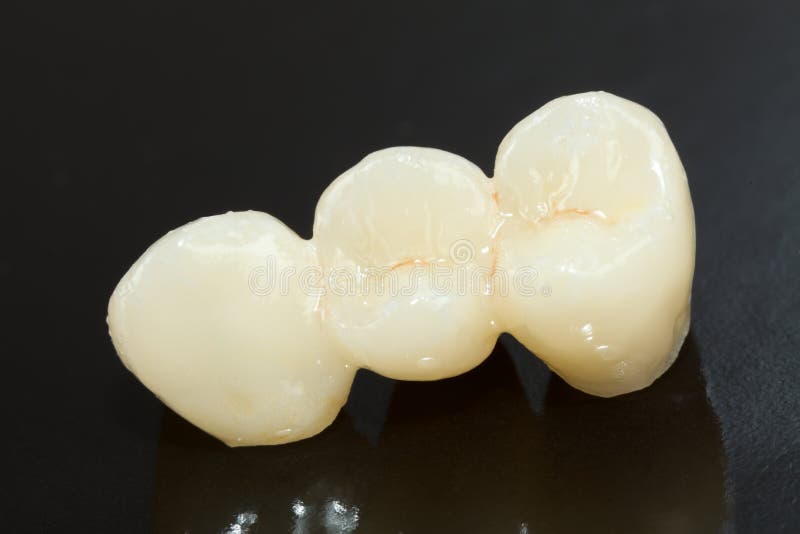 Pressed ceramic teeth royalty free stock images