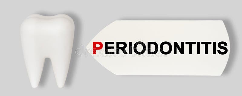 Prevention of dental diseases. Plastic model of the tooth, next to the nameplate - PERIODONTITIS. Medical, dental concept. Prevention of dental diseases. Plastic royalty free stock image