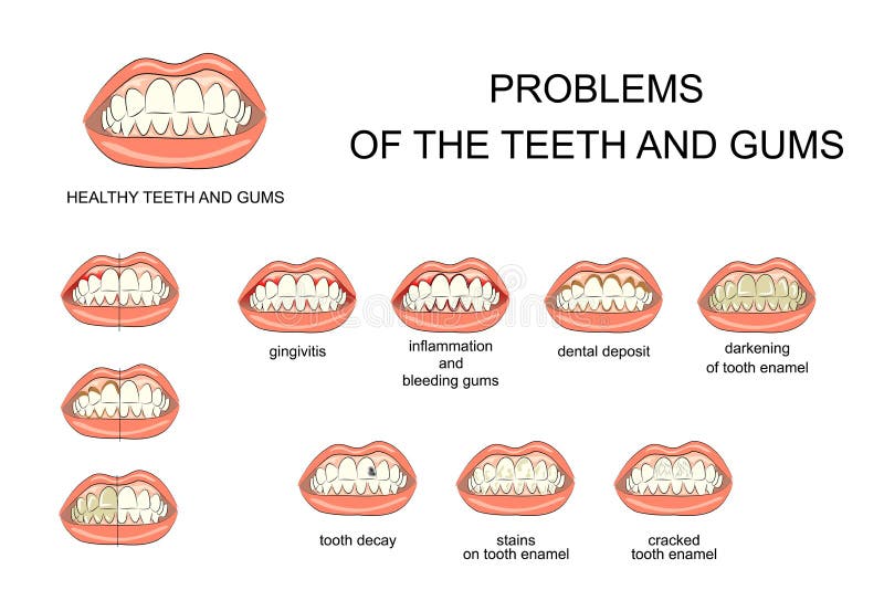 Problems of the teeth and gums vector illustration