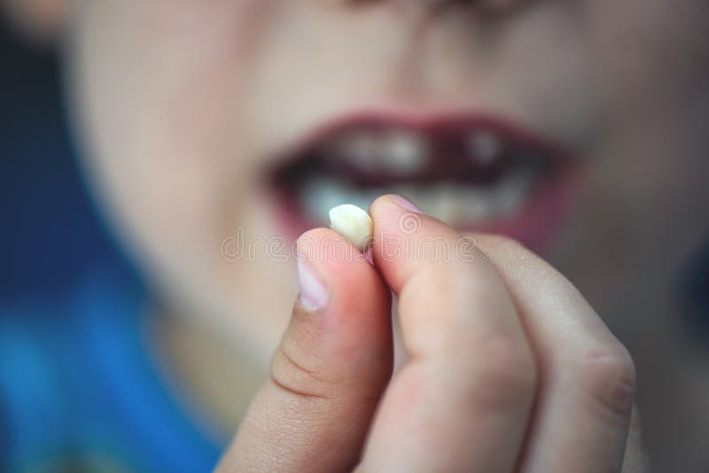 Proud young boy age 6 holds his falling milk teeth. Childhood healthcare concept. Real people royalty free stock photos